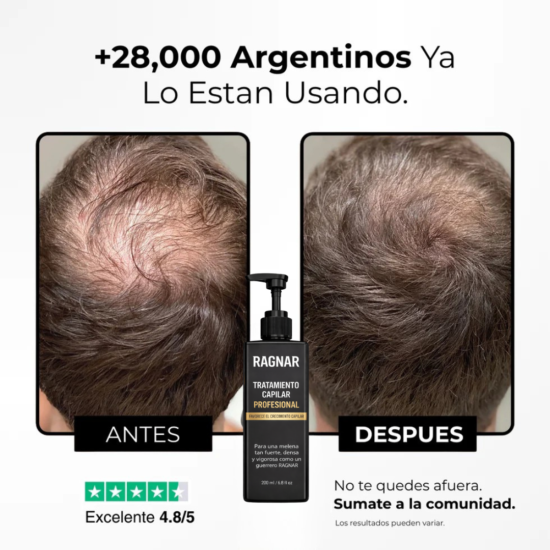 RAGNAR™ - Tratamiento Profesional Activador de Raices Capilares