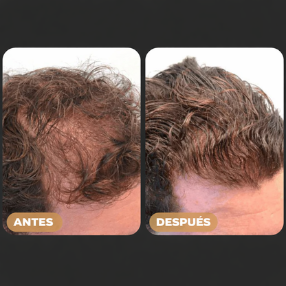 RAGNAR™ | SPRAY Activador de Raices Capilares